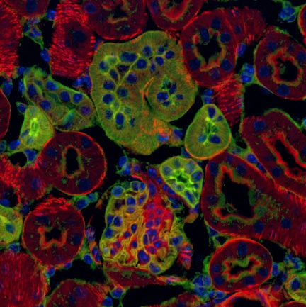 Kvantitativní 3D prostorová analýza tkání kostní dřeně